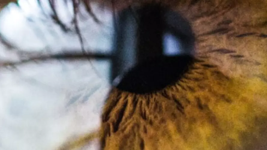 Hazel eye